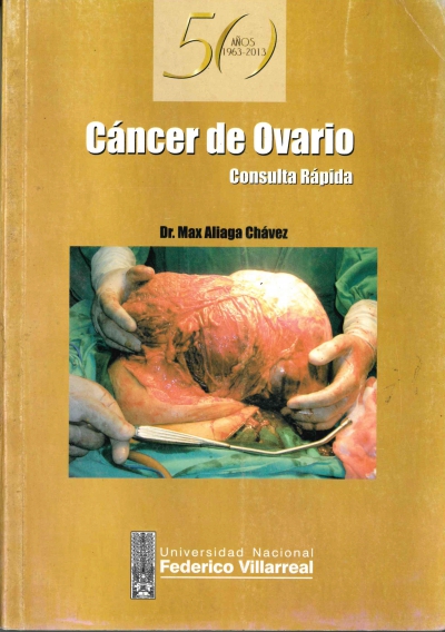 Cáncer de ovario. Consulta rápida